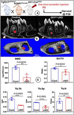 TGF-Beta Receptor II Is Critical for Osteogenic Progenitor Cell Proliferation and Differentiation During Postnatal Alveolar Bone Formation